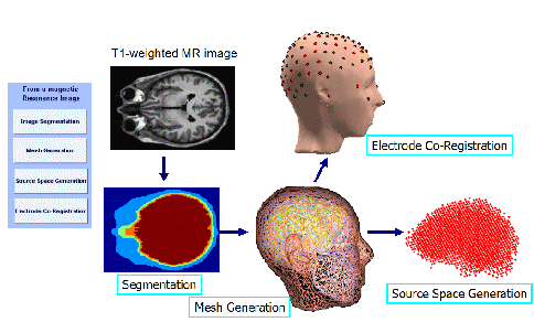 Figure 2: steps of head modeling using MR images