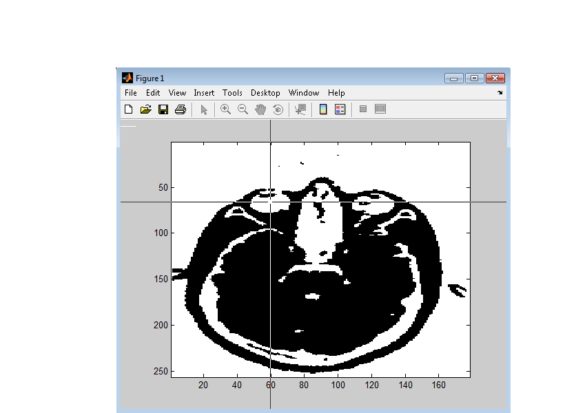 Figure 7: Matlab figure to click on eye lobes.
