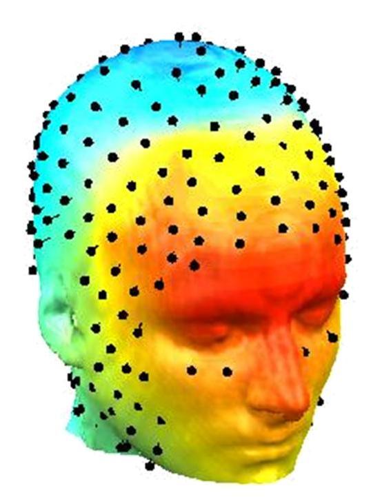 EEG ad alta densità