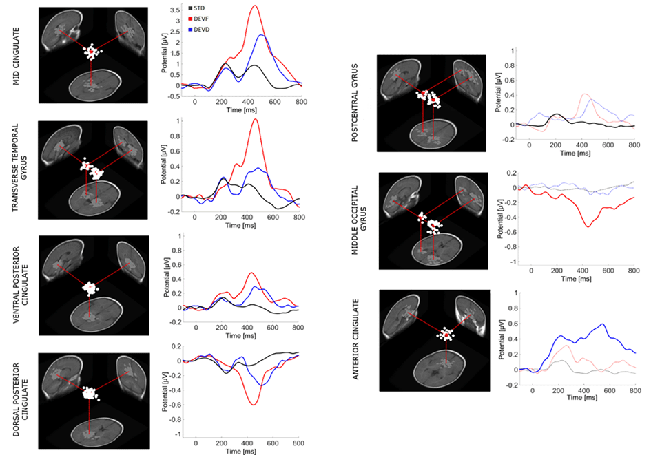   Estimated cortical locations of independent component (IC) clusters of effective sources across subjects that contribute the most to the scalp grand-mean ERP