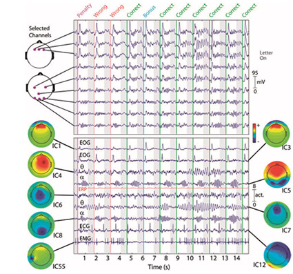 EEG data